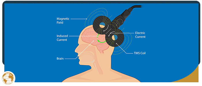 TMS Therapy Specialist Near Me in Creve Coeur MO, St. Louis MO, Independence MO, Columbia MO, and Olathe KS