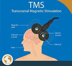 TMS Therapy Near Me in Independence, MO 